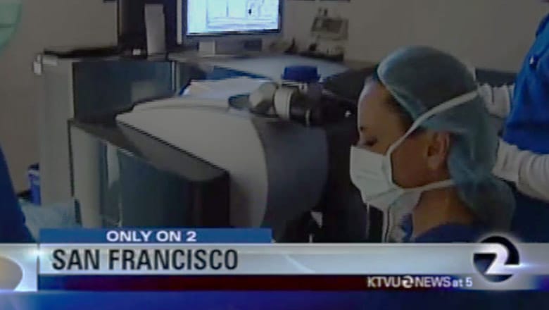 LASIK San Francisco