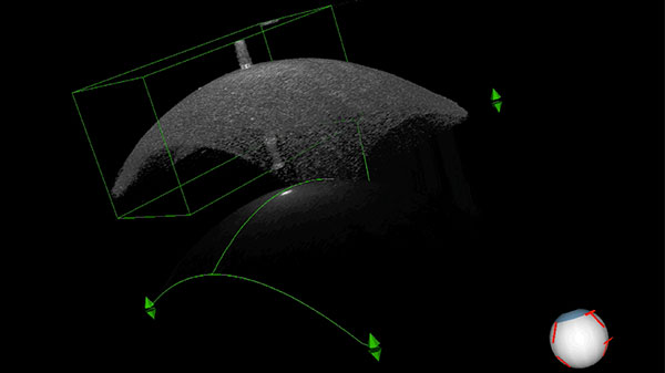 Corneal OCT scan of an eye